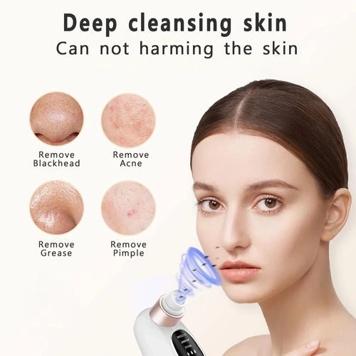 Electric Pore Vacuum Blackhead Remover with Microbubble Technology
